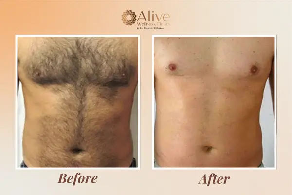 Before and after LHR